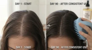 Comparison view demonstrating hair growth progress using a scalp massage brush.